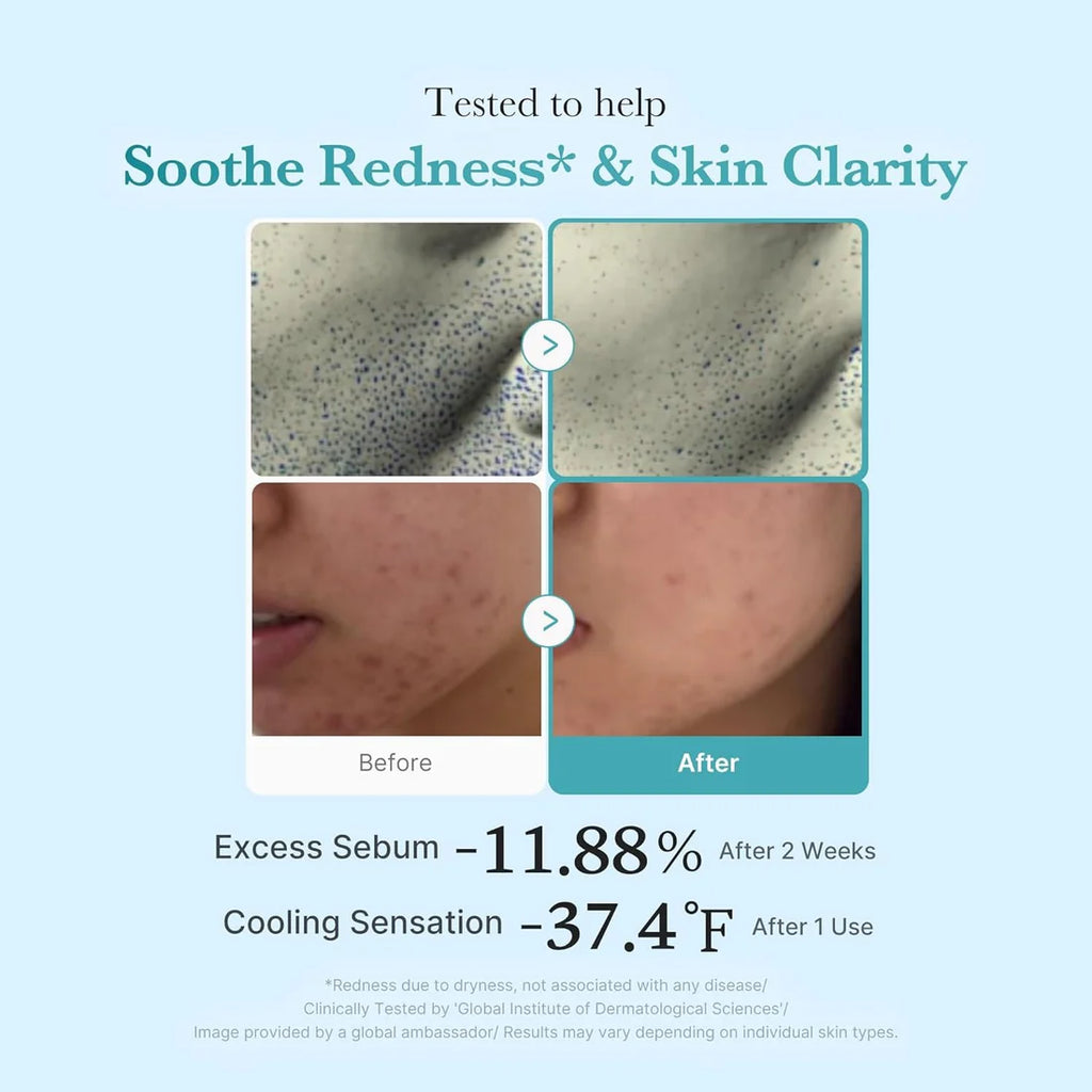 MEDICUBE Azelaic Acid Niacinamide Clear Toner – Refine & Brighten Daily- 250 ml