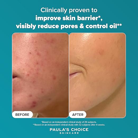 Paula’s Choice Glow Exfoliant