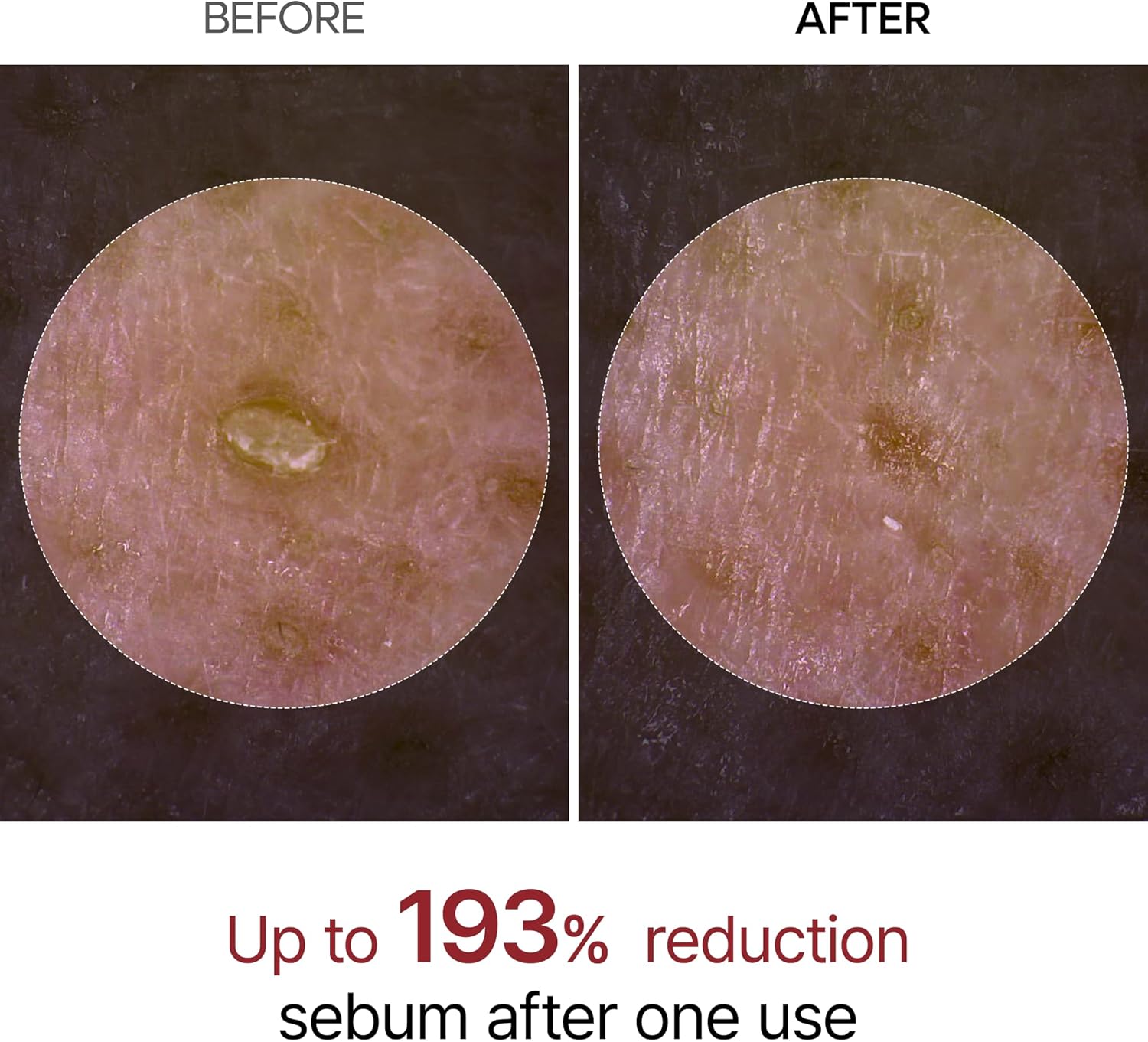 تقشير دكتور ميلاكسين المتوهج