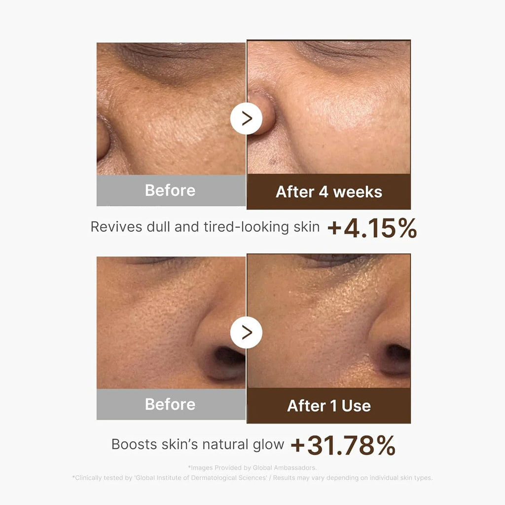 Medicube Deep Vita C Natural Glow Serum Duo