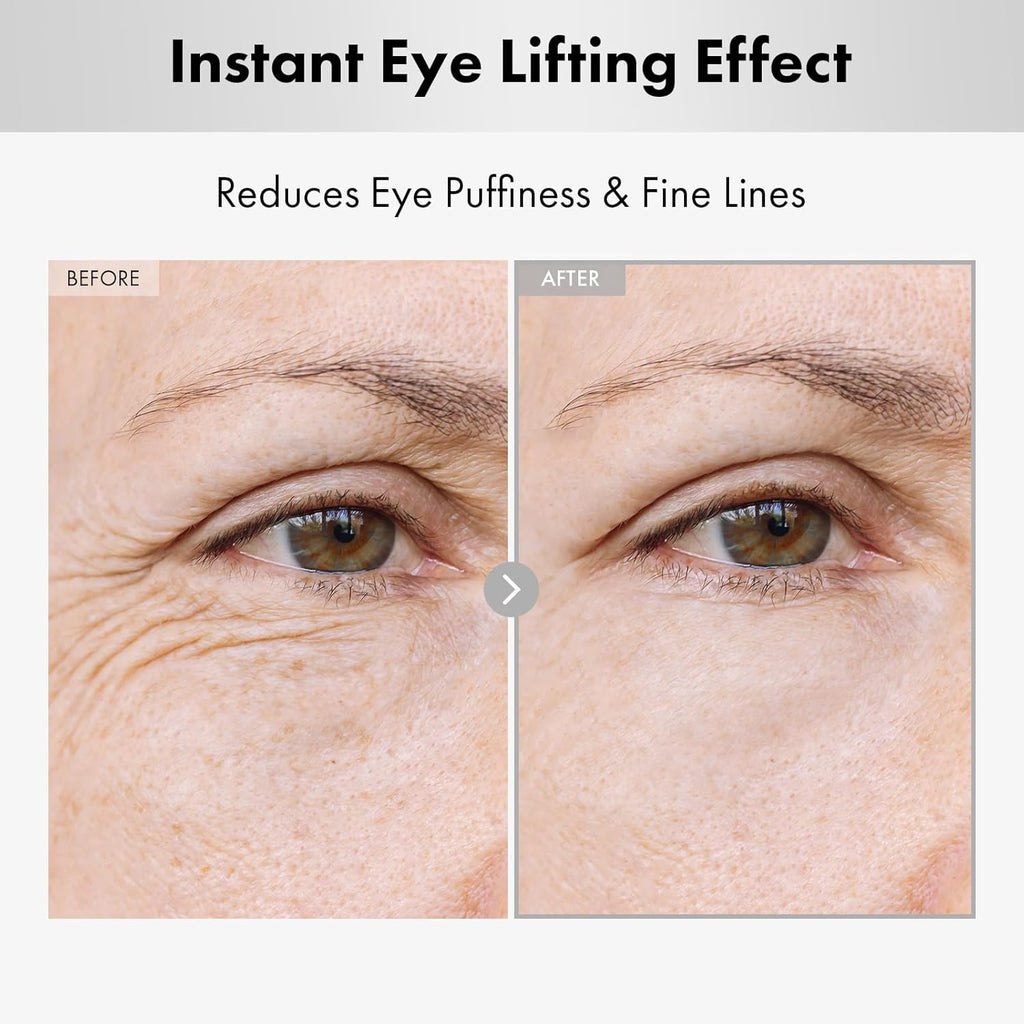 هيالورون برايت آيز