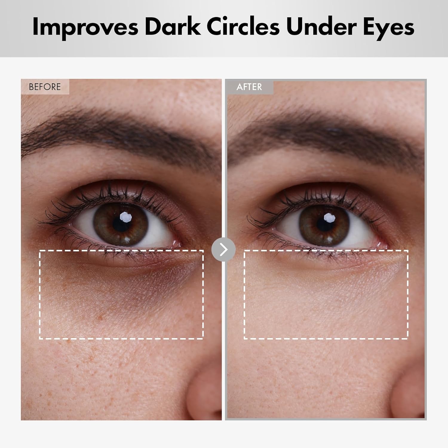 هيالورون برايت آيز