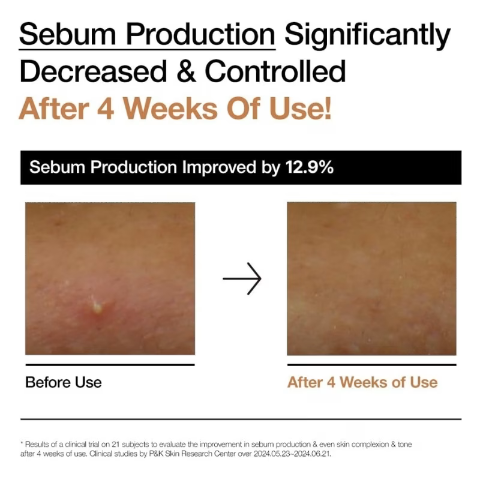 Anua – Rice 70 Glow Milky Toner