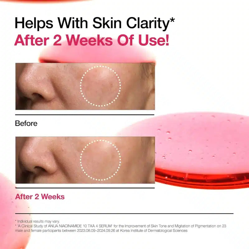 Anua – Niacinamide 10% + TXA 4% Serum
