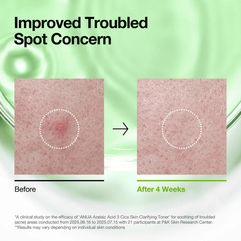 Anua  - Azelaic 3 Cica Skin Clarifying Toner 250ml