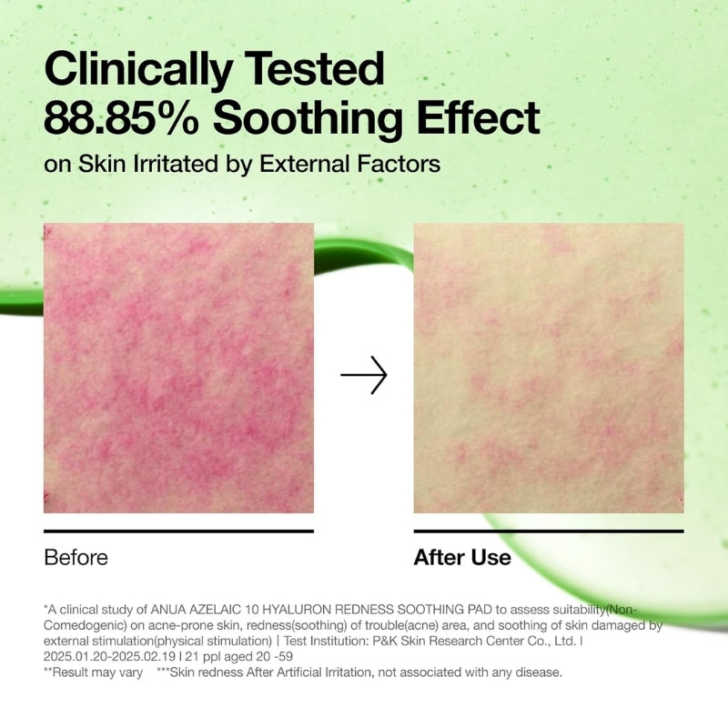 Anua  - Azelaic 10 Hyaluron Redness Soothing Pad (90 pads)