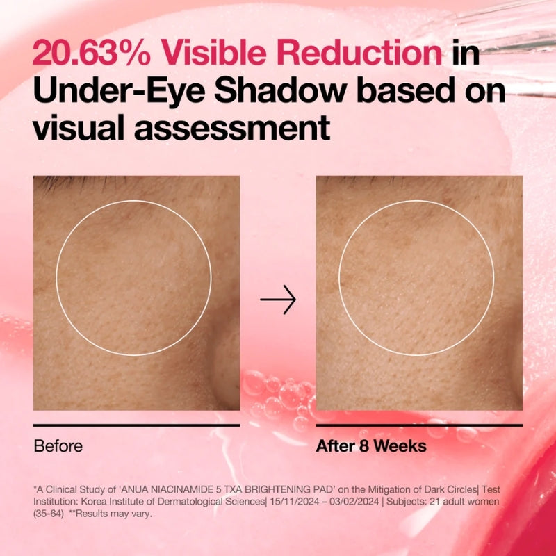 Anua  - Niacinamide 5 TXA Brightening Pad (60 Pads)