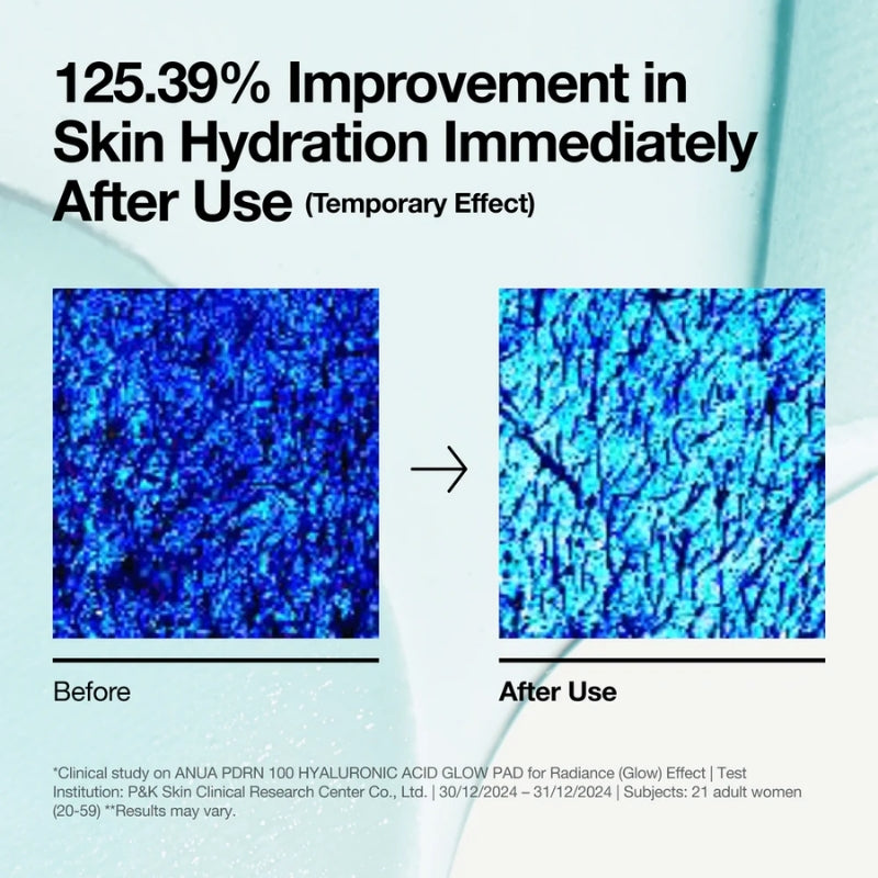 Anua  - PDRN 100 Hyaluronic Acid Glow Pad (60 Pads)