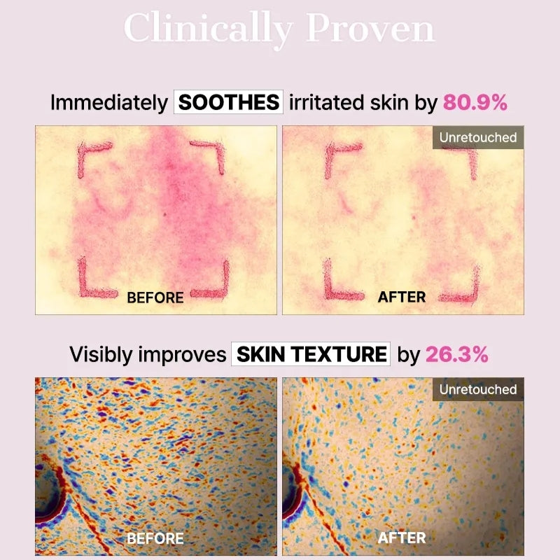 Cosrx  - The Peptide Collagen Lifting Glow Hydrogel Mask (3pcs)