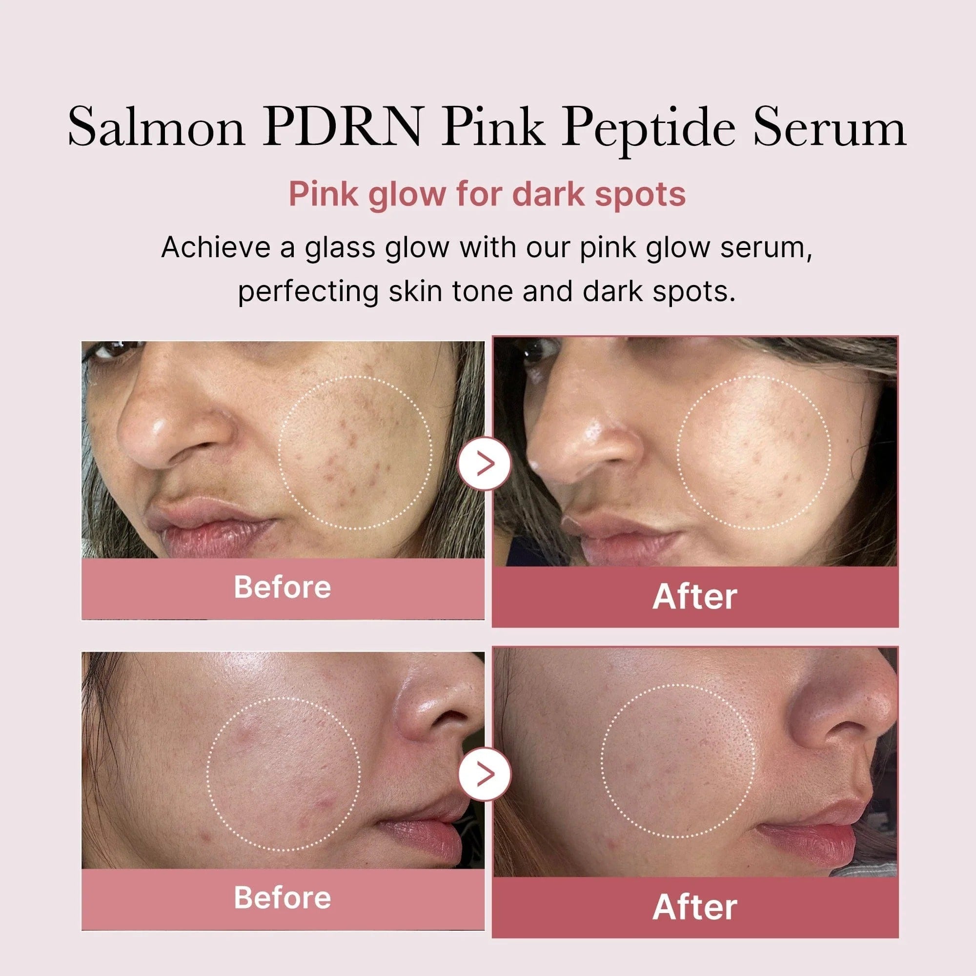 [MEDICUBE] PDRN Peptide Booster Pro Pink Set